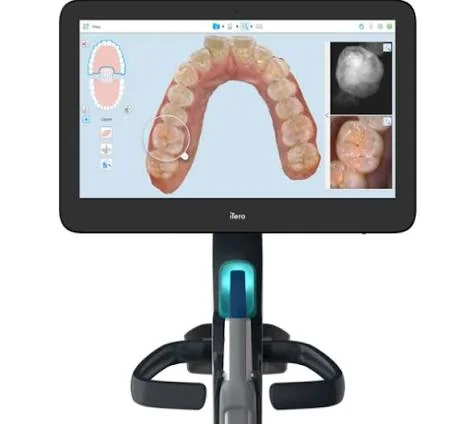Scanner intra-oral iTero pour Invisalign